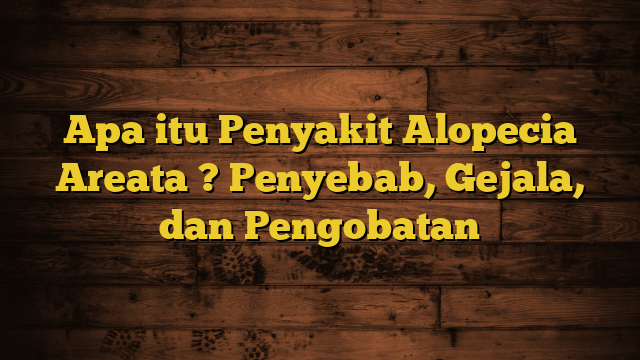 Apa itu Penyakit Alopecia Areata ? Penyebab, Gejala, dan Pengobatan