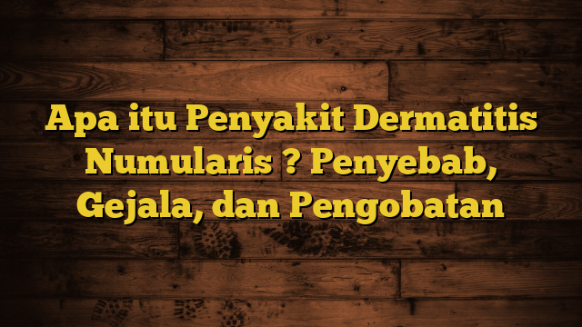 Apa itu Penyakit Dermatitis Numularis ? Penyebab, Gejala, dan Pengobatan