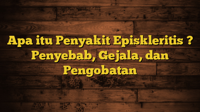 Apa itu Penyakit Episkleritis ? Penyebab, Gejala, dan Pengobatan