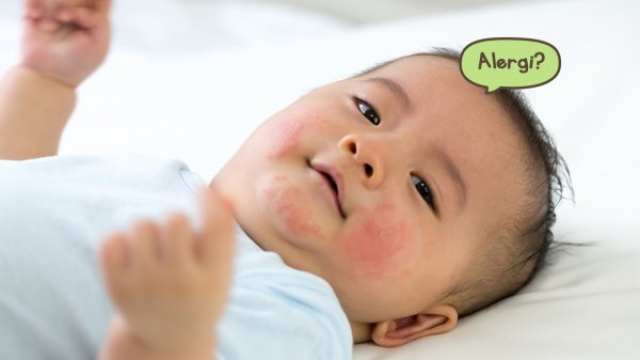 Alergi yang Paling Sering Dialami Bayi dan Cara Mengatasinya